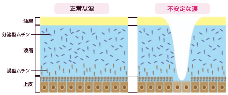 正常な涙と不安定な涙の涙液層比較